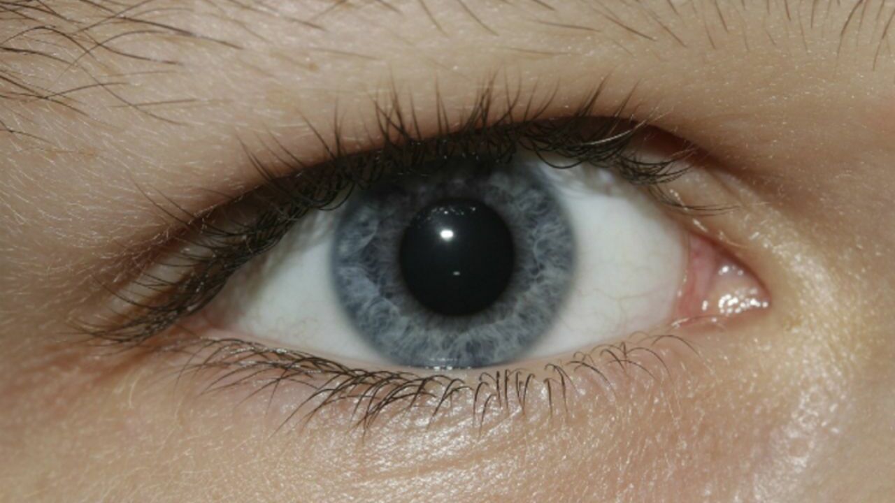 «Дергающийся» глаз может оказаться тревожным симптомом